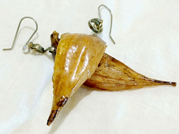 Aretes vida